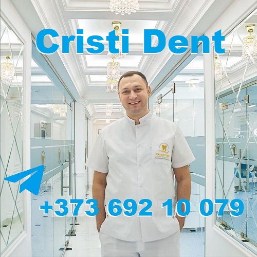 Бесплатная онлайн консультация стоматолога в Кишиневе - клиника «Cristi Dent»
